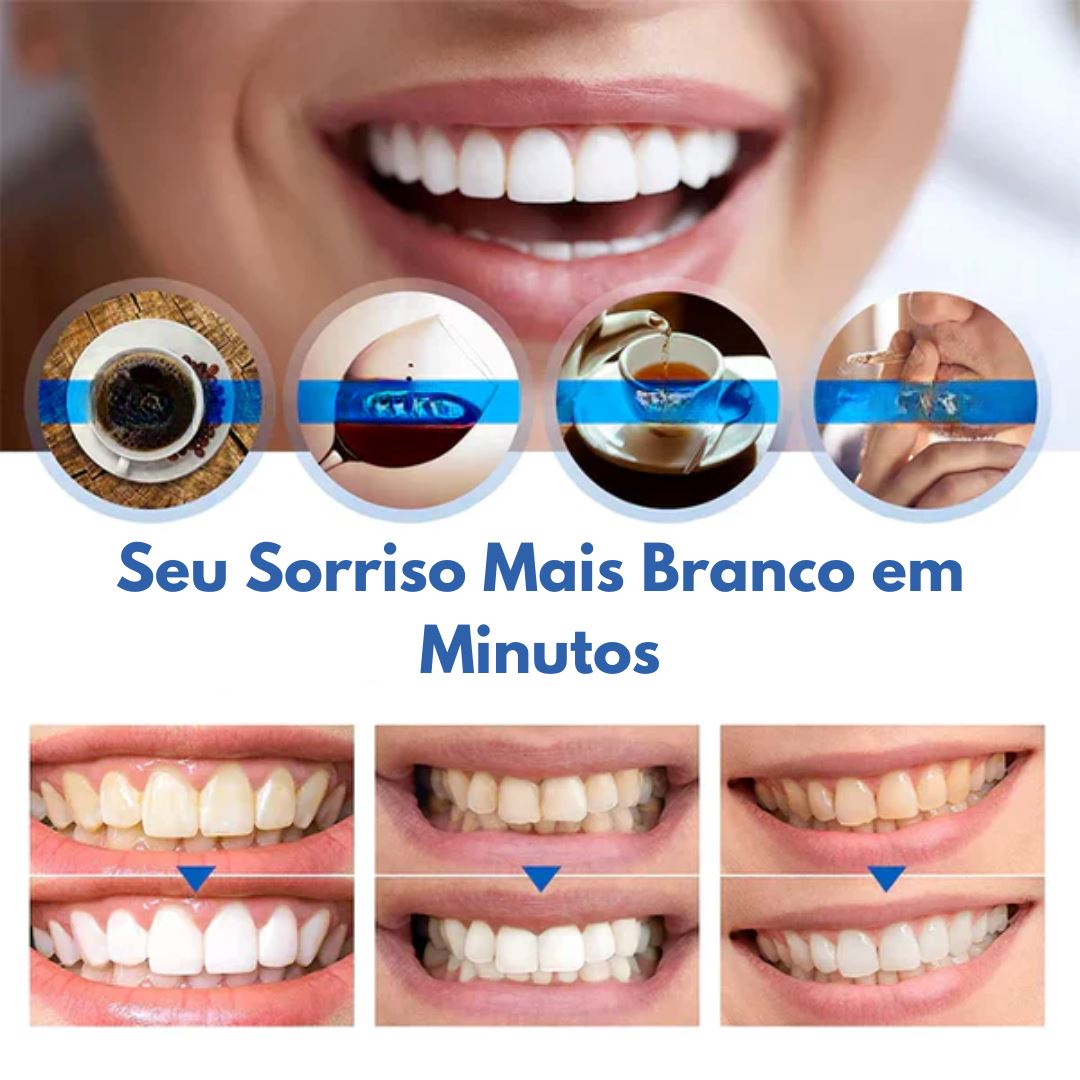 Clareador Dental Ultra White - Denting |COMPRE 1 LEVE 2|