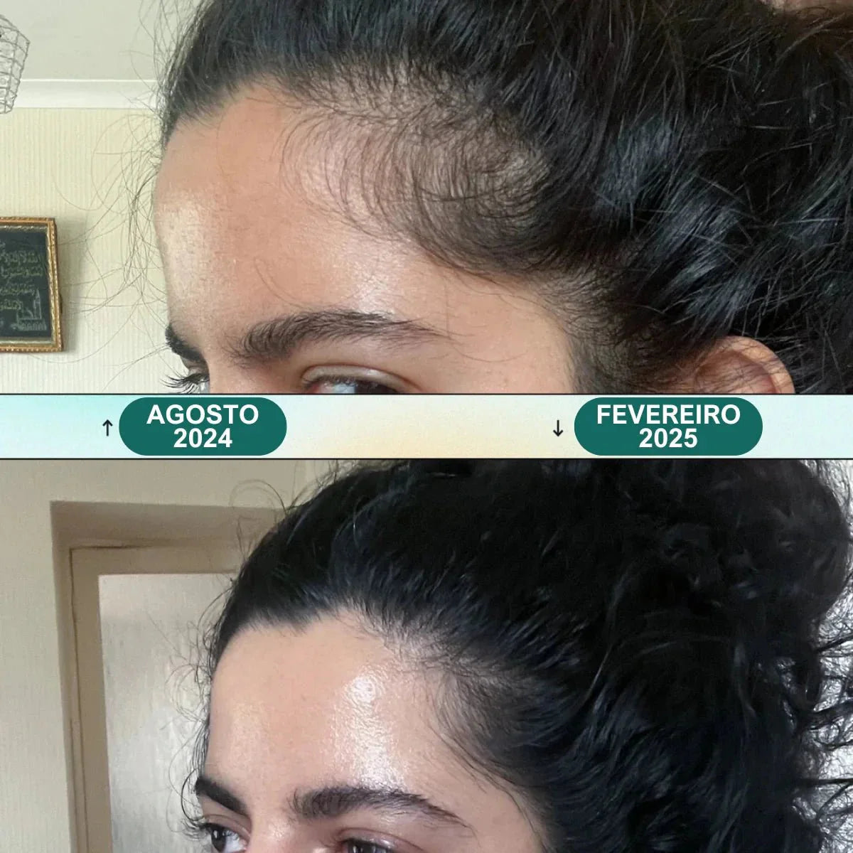 Massageador Elétrico - Renova Hair