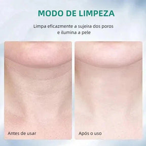 Massageador Elétrico Facial com Fototerapia Anti-Rugas