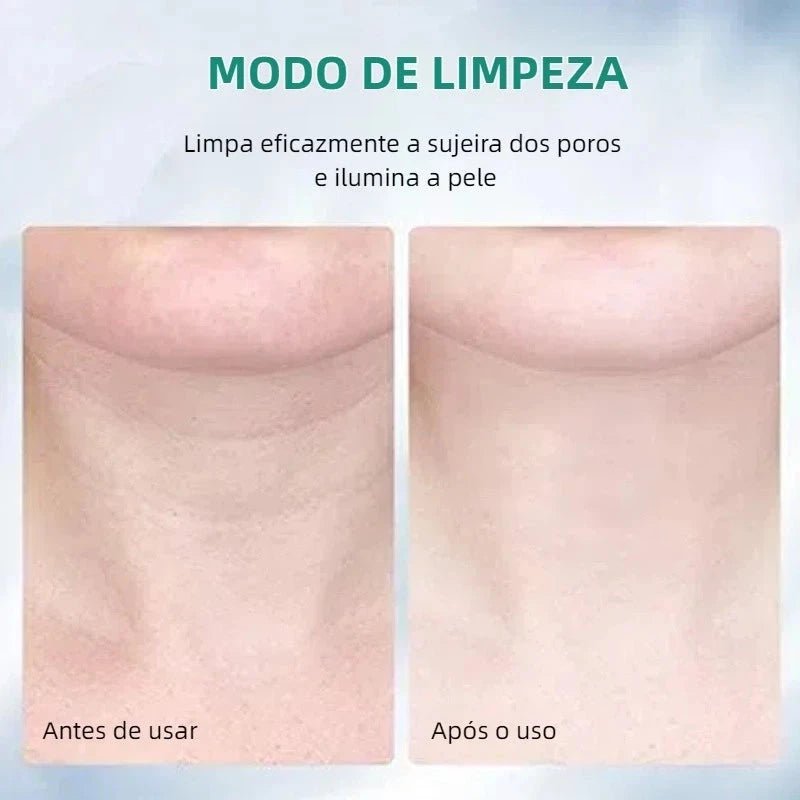 Massageador Elétrico Facial com Fototerapia Anti-Rugas