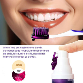 Clareador Dental iziSmile - Dentes Brancos Em Segundos [Desconto + Entrega Gratis Hoje]