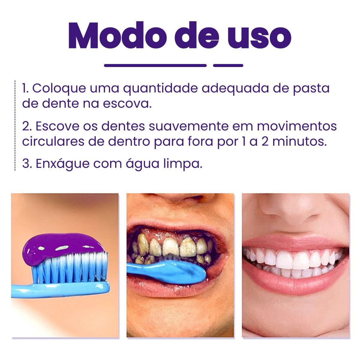 Clareador Dental iziSmile - Dentes Brancos Em Segundos [Desconto + Entrega Gratis Hoje]