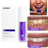 Clareador Dental iziSmile - Dentes Brancos Em Segundos [Desconto + Entrega Gratis Hoje]