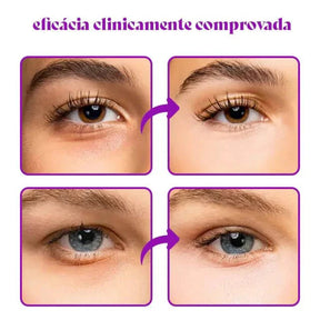 Illuminous - Corretor de Olheiras Que Ilumina e Neutraliza Tons Escuros