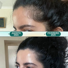 Massageador Elétrico para Couro Cabeludo - Renova Hair