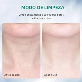 Massageador Facial com Fototerapia Anti-Rugas