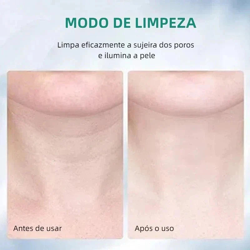 Massageador Facial com Fototerapia Anti-Rugas