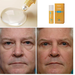 Rolon 5 em 1 Ultra Rejuvenescedor - Luteína Glow®