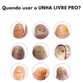 Unha Livre PRO – Solução Avançada para Unhas Saudáveis